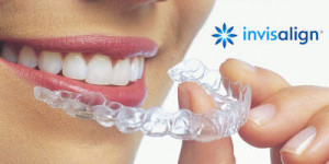 Ortodonzia Invisalign