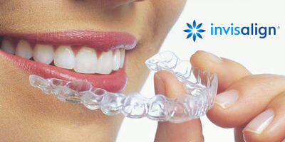 Invisalign Orthodontics