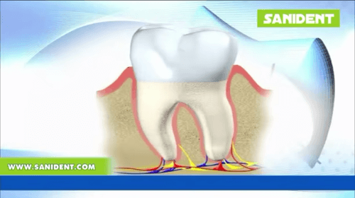 Video - Periodontal disease