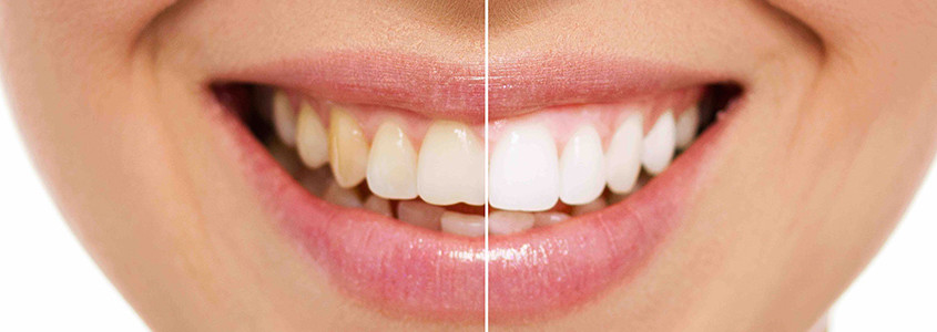Risultati immagini per denti