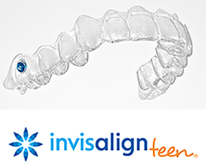 invisalign 2