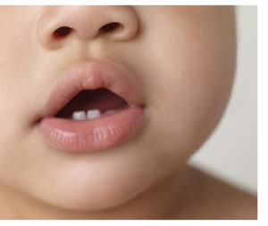 children's tooth enamel