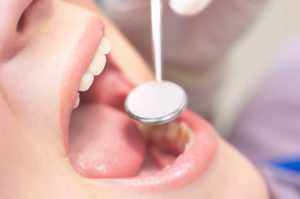 cure odontoiatriche risparmio