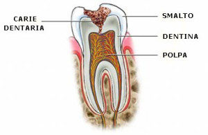 caries conservative dentistry