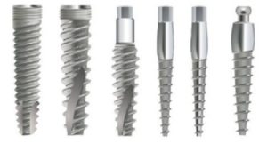 implantology history parts of a dental implant