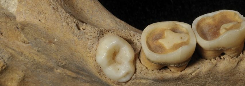 tooth study