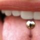 lip or tongue piercing
