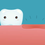 perdita di un dente dentista Milano