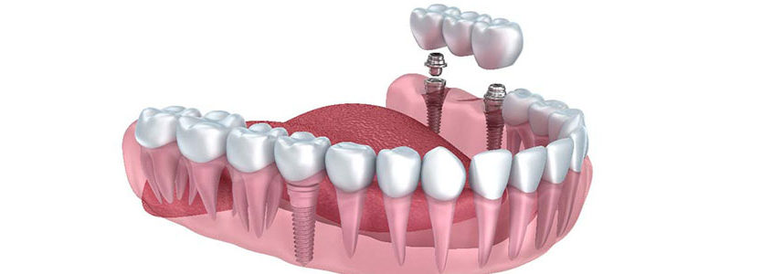 clinica del benessere dentale
