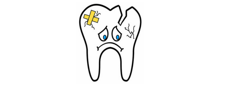 reimpiantare un dente caduto