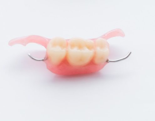 Protesi rimovibile di 3 denti