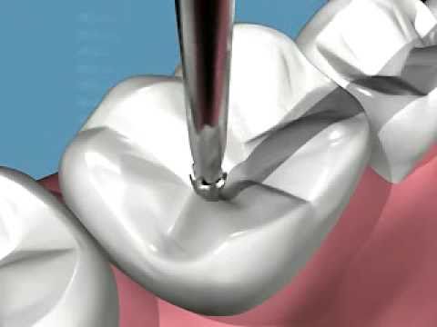 odontoiatria conservativa sanident milano