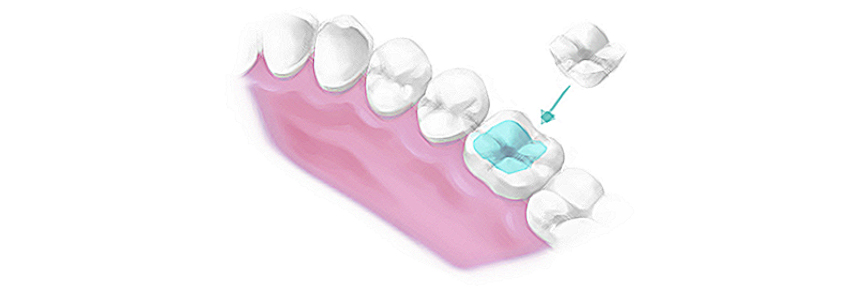 conservative dentistry