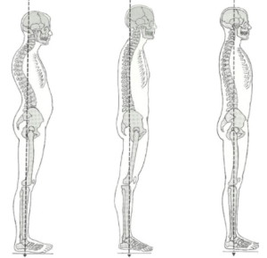 cervical pain and teeth