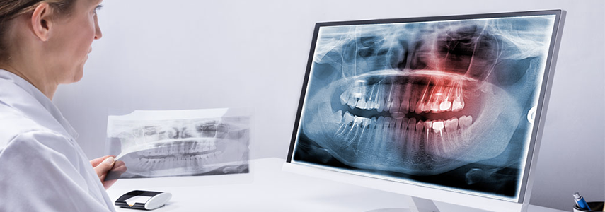 contraindications for implantology