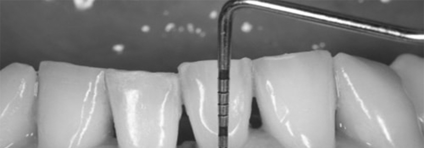 periodontal survey