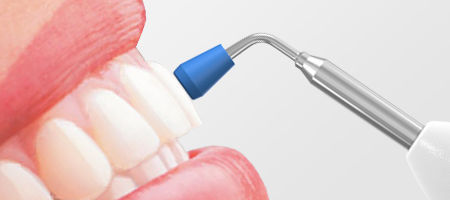 test vitalità del dente