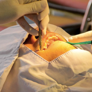 chirurgia orale tempi di intervento