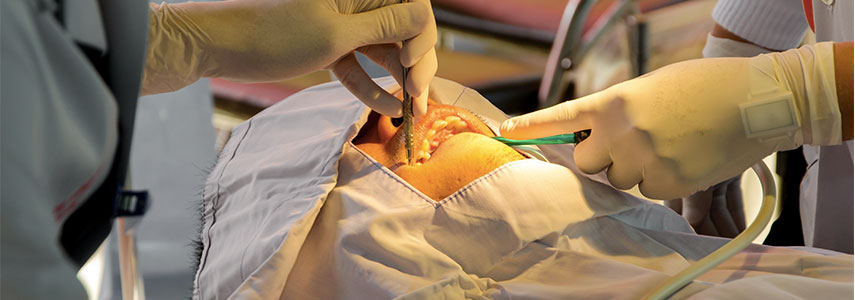 chirurgia orale tempi di intervento
