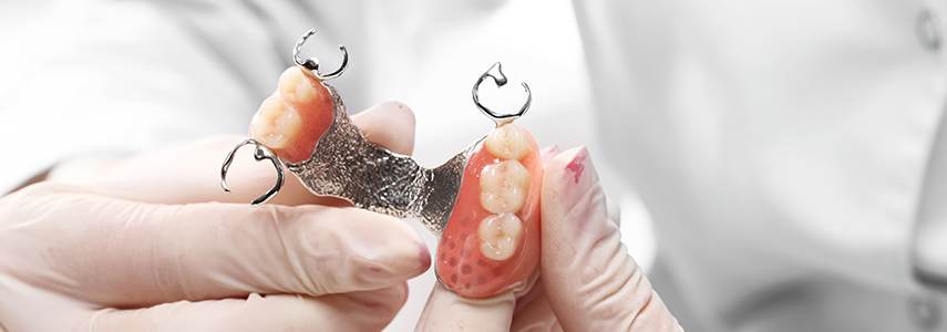 removable partial dentures dentist milan