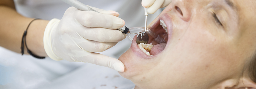 treat periodontitis dentist milan