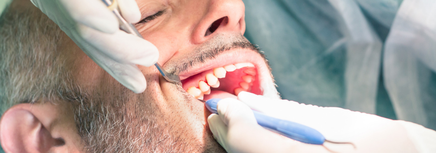 dolore dopo la devitalizzazione dentista milano