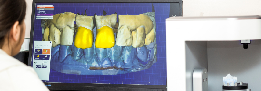 interproximal caries